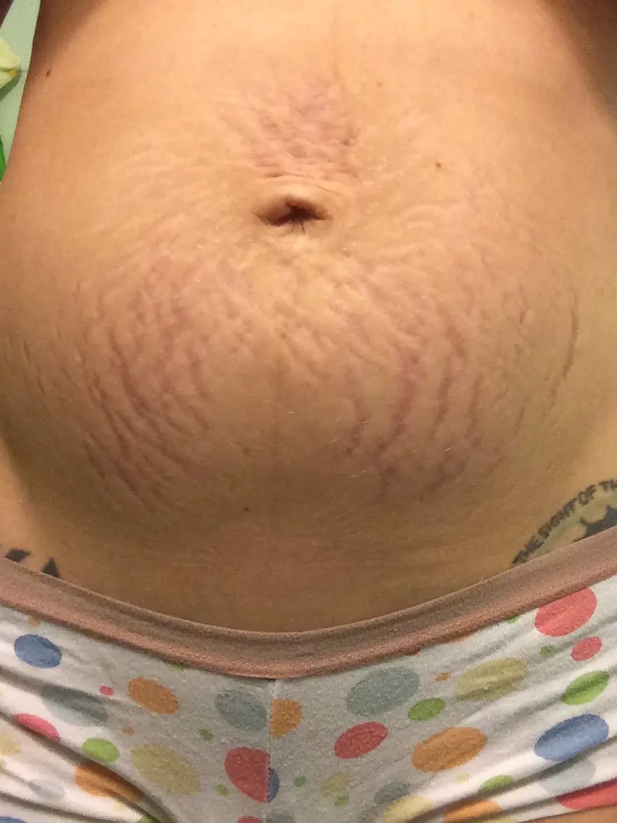 2 weeks postpartum